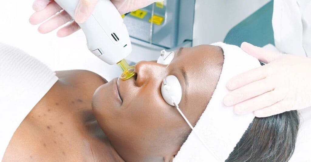 laser hair removal jobs broward county